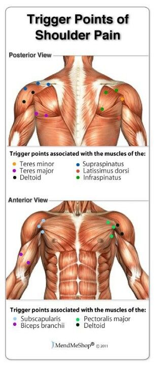 Trigger points of shoulder pain Punkty Spustowe, Autogenic Training, Trigger Point Therapy, Frozen Shoulder, Sports Massage, Rotator Cuff, Trigger Points, Massage Techniques, Shoulder Pain