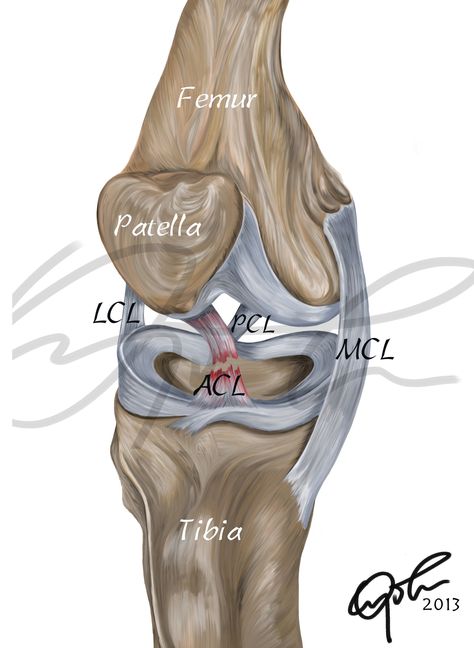 This digital painting depicts the anatomy of a torn ACL (Anterior Cruciate Ligament) This is a digital printable download that you can use in presentations, written editorials etc. You can also frame it up and use to beautify your office or living space should you be so inclined.  Oh and one more thing...  Please note that although the display image has a signature watermark for protective purposes, the actual download is signature watermark FREE. Thanks for stopping by! Drawing Human Anatomy, Human Knee, Medical Drawings, Knee Ligaments, Studera Motivation, Nursing School Motivation, Basic Anatomy And Physiology, Nurse Study Notes, Nursing Student Tips