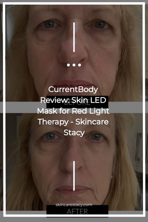 CurrentBody Review: Skin LED Mask for Red Light Therapy - Skincare Stacy Red Light Therapy Before And After, Red Light Mask, Led Light Therapy Mask, Light Therapy Mask, Light Mask, Nasolabial Folds, Led Mask, Skin Tissue, Led Light Therapy