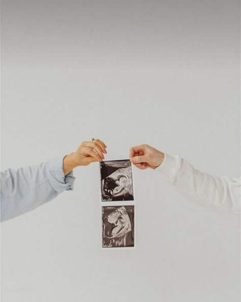 Sonogram Photoshoot Ideas, Maternity Self Portrait Ideas, Ultrasound Photo Announcement, Ultrasound Picture Announcement, Italy Pregnancy Announcement, Baby Announcements Photoshoot, Minimalist Baby Announcement, Studio Baby Announcement, Maternity Announcement Photography