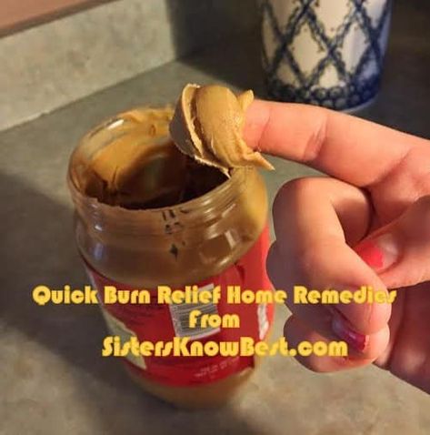 Diy Burn Relief, Burn Relief Skin, Burn Remedies, Burn Remedy, Burn Relief, Treat Burns, Brownie Recipes Healthy, Pumpkin Brownies, Carob Chips