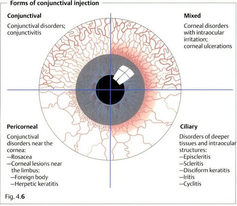 Opthalmic Technician, Optometry Education, Eye Medicine, Hospital Ward, Optometry School, Eye Facts, Eye Anatomy, Family Nurse Practitioner, Medical Studies