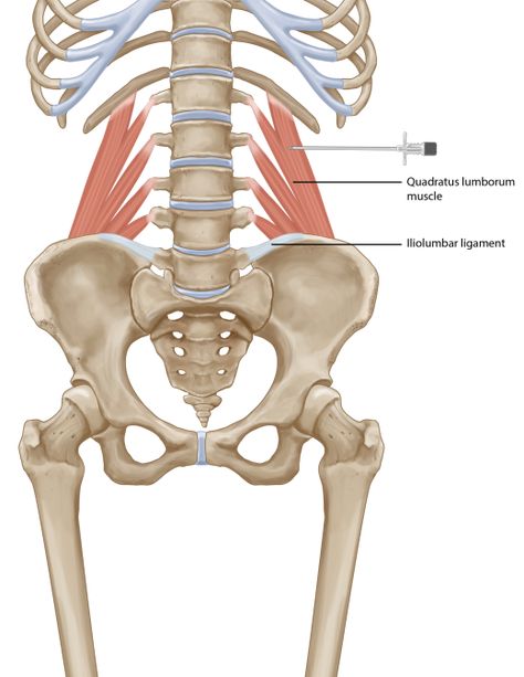 Quadratus Lumborum, Gluteus Maximus Anatomy, Flexor Digitorum Profundus, Quadratics Lumborum Stretch, Posterior Muscles Anatomy, Thoracic Cage, Myofascial Pain Syndrome, Referred Pain, Chronic Lower Back Pain