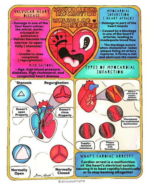 Myocardial Infarct, Cardiac Pathology, Cath Lab Nursing, Nurse Study, Magazine Cover Ideas, Heart Project, Medical Notes, Cardiac Disease, Infographic Layout