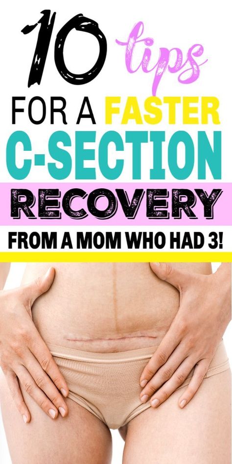 Post C Section, C Section Workout, Cesarean Delivery, C Section Scars, C Section Recovery, Body After Baby, Postpartum Belly, Pumping Moms, Postpartum Body