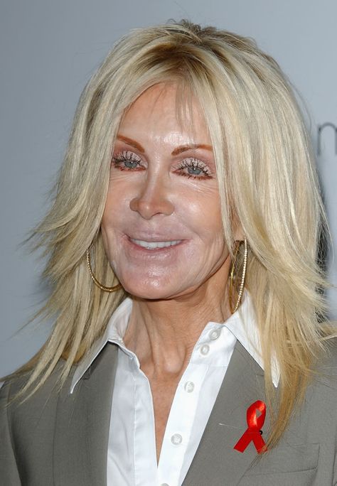 Joan Van Ark Joan Van Ark, Bad Plastic Surgeries, Plastic Surgery Fail, Beauty Myth, Plastic Surgery Gone Wrong, Botox Lips, Knots Landing, Droopy Eyes, Awkward Photos