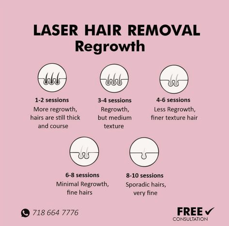 Laser Removal Hair, Laser Hair Removal Tips, Lasers Aesthetic, Laser Hair Removal Black Women, Laser Hair Removal At Home, Hair Removal Laser, Laser Hair Remover, Customer Review Design, Laser Hair Removal Benefits