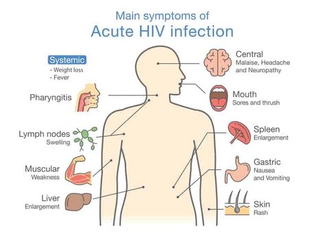 Primary HIV infection is contagious, so the infected person may infect the others having no idea about it. Read more about primary HIV infection. Symptoms Of Aids, What Is Aids, Hiv Facts, Aids Symptoms, Hiv Symptoms, Antiretroviral Therapy, Nursing School Survival, Medical Tests, Lymph Nodes