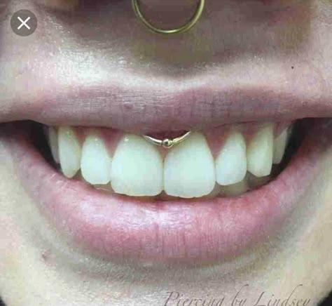 Gold Smiley Piercing, Smiley Piercing Aesthetic, Smiley Piercing Jewelry, Smiley Piercing Rings, Smile Piercing, Secret Tattoos, Pretty Piercings, Smiley Piercing, Tooth Gems