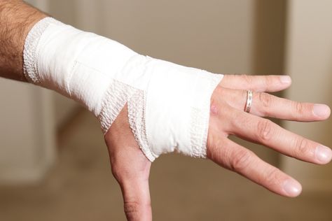 How To Wrap A Wrist With Athletic Tape | LIVESTRONG.COM Bandaged Hands, Wrist Injury, Prevent Blisters, Sports Tape, How To Wrap, Athletic Trainer, Athletic Training, Wrist Wrap, Sports Injury