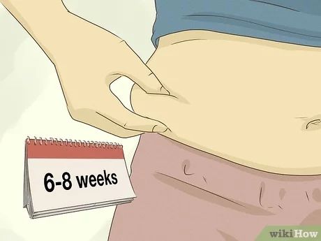 How to Reduce Your Belly After a C-Section: 10 Best Ways C Section Belly, Weight Los, C Section, Reading, 10 Things