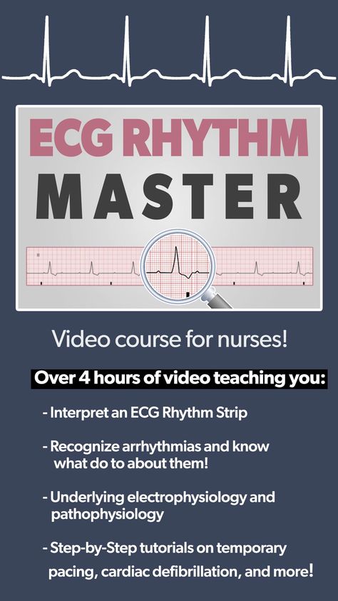 Ekg Interpretation Made Easy, New Nurse Tips, Pcu Nurse, Ekg Technician, Ekg Rhythms, Nursing Cardiac, Nursing School Studying Cheat Sheets, Er Nursing, Cardiac Rehab