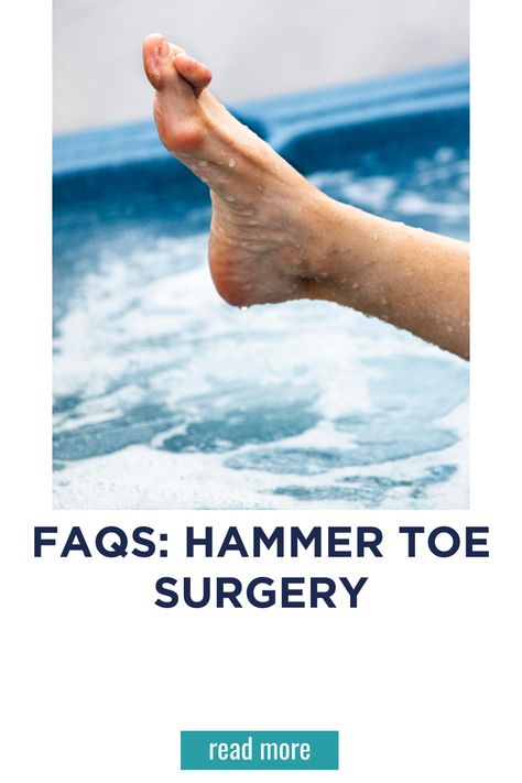 FAQs: Hammer Toe Surgery Open Toed Shoes, Foot Health, Health Education, Many People, Surgery, Conditioner, Wonder, Education, Health