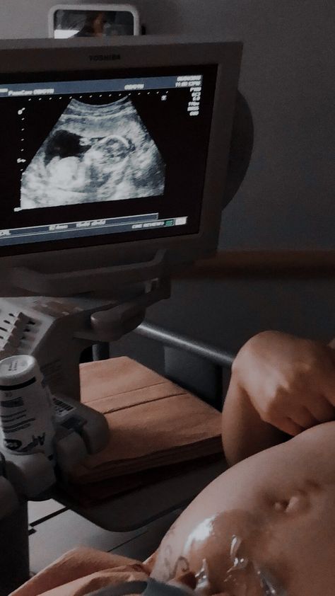 Sonography Student, Nursing School Inspiration, Midwifery Student, Ultrasound Technician, Diagnostic Medical Sonography, First Ultrasound, Baby Ultrasound, Nursing School Motivation, Medical School Life