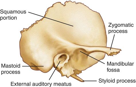 Temporal Bone, Skeletal System Anatomy, Dog Funnies, Axial Skeleton, Paranasal Sinuses, Internal Carotid Artery, Facial Bones, Medical Dictionary, Anatomy Bones