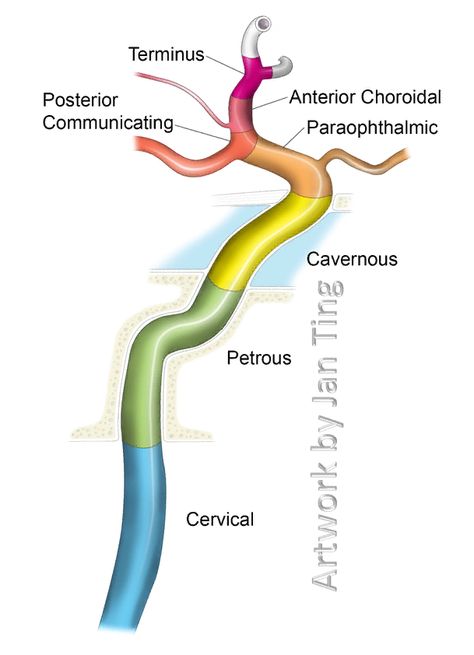 Internal Carotid Artery NYU Classification Atlas Anatomy, Nervous System Anatomy, Vascular Ultrasound, Internal Carotid Artery, Mri Brain, Diagnostic Medical Sonography, Eye Facts, Gross Anatomy, Brain Surgeon