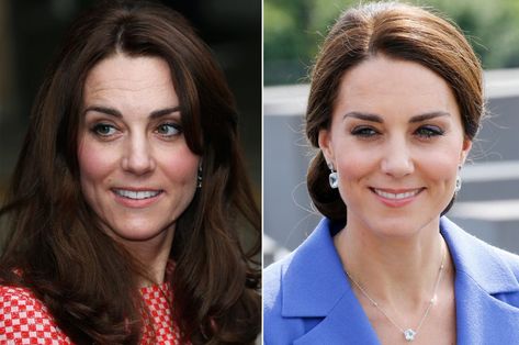 Palace denies Kate Middleton got 'baby botox' Baby Botox Before And After, Botox Before And After, Celebrities Before And After, Plastic Surgeon, Royal Engagement, Cosmetic Surgery, Famous Celebrities, Plastic Surgery, Duchess Of Cambridge