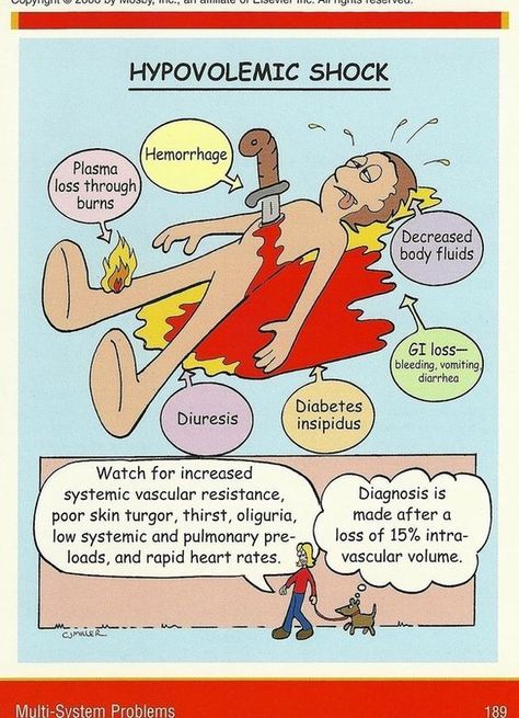 Hypovolemic Shock, Nursing Board, Med Surg Nursing, Nursing Mnemonics, Surgical Nursing, Medical Surgical Nursing, Critical Care Nursing, Nurse Rock, Nursing School Studying