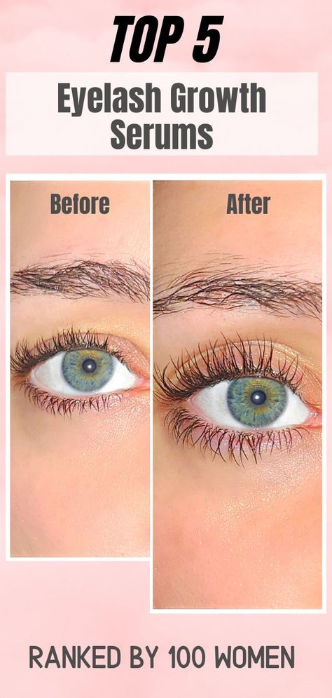 Long Natural Eyelashes, Eyelash Growth Vaseline, Latisse Eyelashes, Long Lashes Serum, Eyelash Growth Cycle, Grande Lash Serum, Eyelash Growth Diy, Eyelash Serums, Best Lash Serum