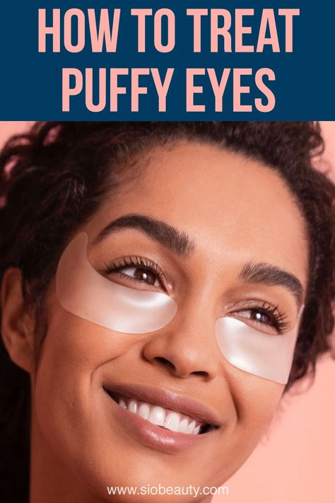 woman wearing eye patches to get rid of puffy eyes and bags Under Eye Puffiness Remedies, How To Get Rid Of Eye Bags Fast, Puffy Under Eyes Bags, Baggy Eyes Remedy, Bags Under Eyes Remedy, Eye Bags Remedy, Undereye Bags Remedy, Puffy Under Eyes, Puffy Eyes Remedy