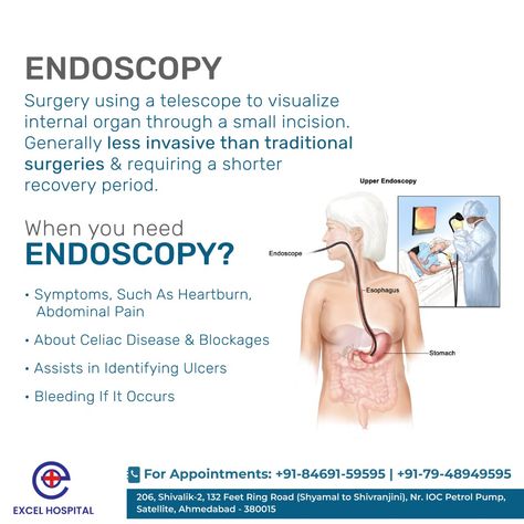 Endoscopy Procedure, Medical Doctor, Abdominal Pain, Ahmedabad, Medical Conditions, Do You Need, Surgery, Disease, Health Care