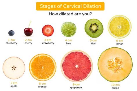 When you go into labour, your cervix starts to dilate to make room for your baby to come out. But what does it feel like? And how long does it take? We've got all your dilation questions answered, with the help of expert GP Dr Philippa Kaye Dilation Chart, Dilation And Effacement, Cervical Dilation, Strawberry Lime, Makeup Geek, Labour, Grapefruit, Kiwi, Melon