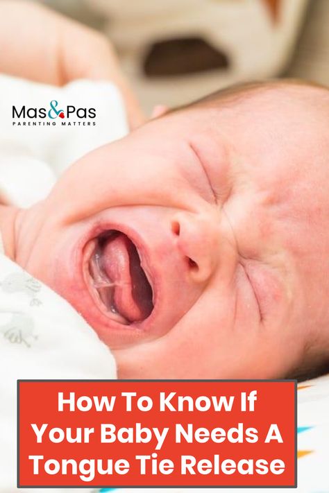 There are many reasons why mums can find it hard to breastfeed their babies but one reason that is growing in awareness is that of tongue-tie. But what is tongue tie exactly and how do you know if your baby has it? How do you know if tongue tie is affecting your baby’s breastfeeding and what can you do about it?We explore all this including tongue tie release procedures, and what help is available to new mothers below. #babies #parentingtips #babyissues #tonguetie #breastfeedingtips Baby Tongue, Breastfeeding Positions, Newborn Mom, Tongue Health, Tongue Tie, Plank Workout, Baby Advice, Breastfeeding Tips, Parent Resources