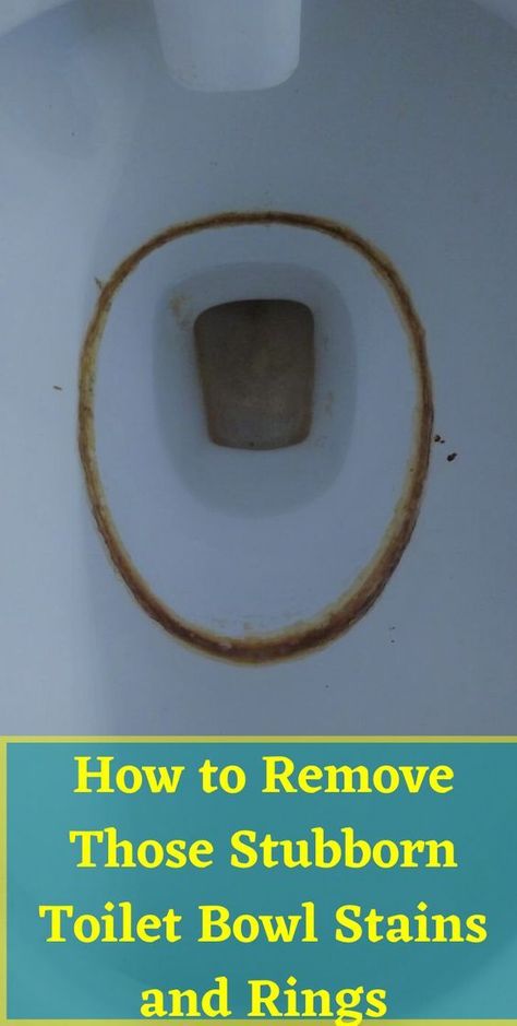 Toilet Hard Water Stains, Cleaning Toilet Ring, Clean Toilet Stains, Cleaning Toilet Stains, Clean Toilet Bowl Stains, Toilet Bowl Stains, Remove Yellow Stains, Toilet Ring, Toilet Stains