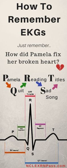 EKG interpretation made easy. If you are a nursing student looking for help with learning and understanding 12 lead ekgs and cardiac rhythms this article is for you! Cardiology is no joke in nursing school so sometimes you have to bring complicated concepts back to the basics. Simple steps to understand EKGs #ekginterpretation #nclex #nursingstudents #nursingschool EKG interpretation made easy. If you are a nursing student looking for help with learning and understanding 12 lead ekgs and cardiac Ekg Interpretation, Medical Assistant Student, Nursing Information, Nursing Mnemonics, Cardiac Nursing, Nursing School Survival, Nursing School Studying, Nursing School Tips, Nursing School Notes