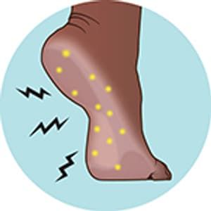 Circulation Remedies, Increase Circulation, Poor Leg Circulation Remedies, Help Circulation, Bad Circulation In Legs Symptoms, Exercises To Improve Leg Circulation, Leg Circulation Remedies, Poor Circulation In Legs Remedies, Poor Circulation Symptoms