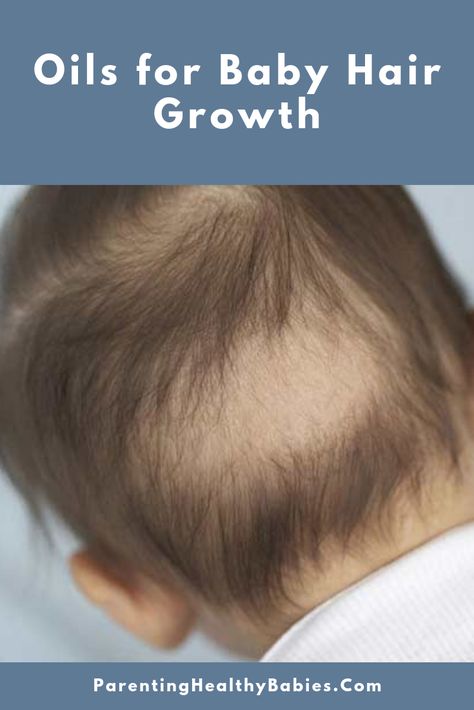 Baby Hair Growth Tips, Baby Hair Growth Remedies, Baby Oil For Hair, Grow Baby Hair, Hair Groth, Best Hair Oils, Baby Hair Growth, Faster Hair Growth, Essential Oils For Babies