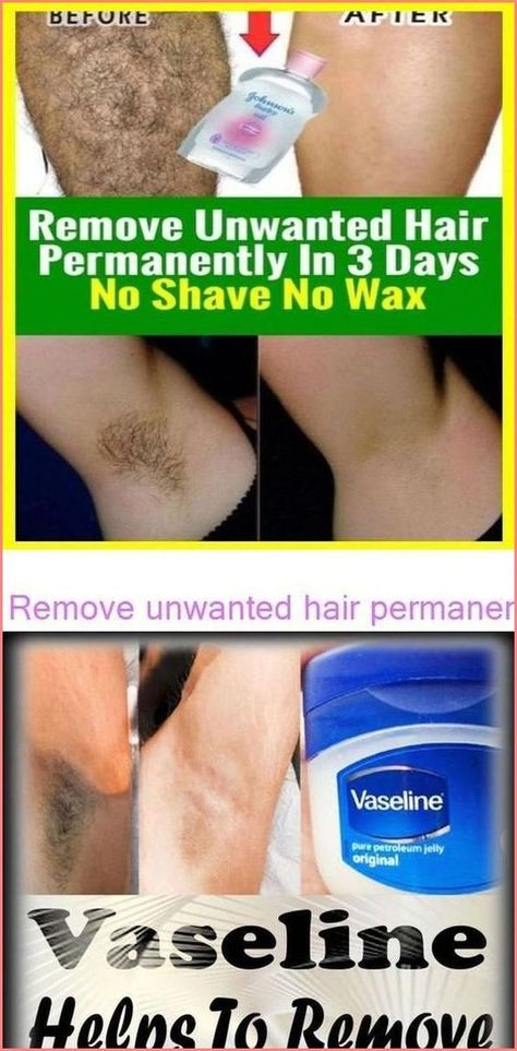 How To Get Rid Of Unwanted Hair Permanently Back Hair Removal, Unwanted Hair Permanently, Unwanted Hair Growth, Remove Unwanted Hair, Underarm Hair Removal, Hair Removal For Men, Unwanted Facial Hair, Remove Hair, Facial Hair Removal