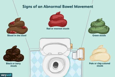 What It Means to Have a Normal Bowel Movement Fecal Impaction, Rectal Prolapse, Healthy Bowel Movement, Soft Stool, Chronic Constipation, Bowel Movement, Irritable Bowel, Food Intolerance, Lose 20 Pounds