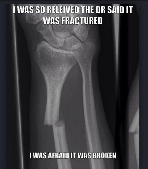 I seriously hear this all the time at work. Me "so you have a wrist fracture" patient "no, it's not just fractured, it's completely broken!"  ITS THE SAME THING!!! Radiography Humor, Xray Tech Humor, Athletic Training Humor, Medische Humor, Funny Xray, Rad Tech Humor, Wrist Fracture, Orthopedic Nurse, Ortho Nurse