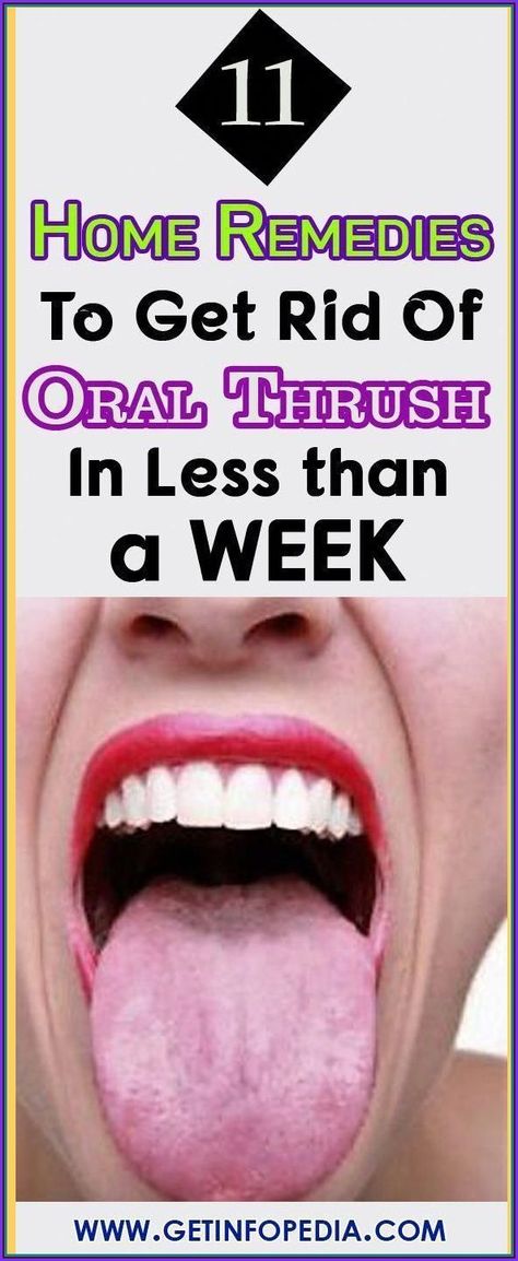 Regular dental visits keep your mouth fresh, your breath smelling fresh and your teeth whiter. Contact your dentist to schedule your….
#gumpainremedy Dental Health Care, Hygiene Care, Periodontal Disease, How To Prevent Cavities, Oral Care Routine, Receding Gums, Gum Care, Health Care Tips, Oral Health Care