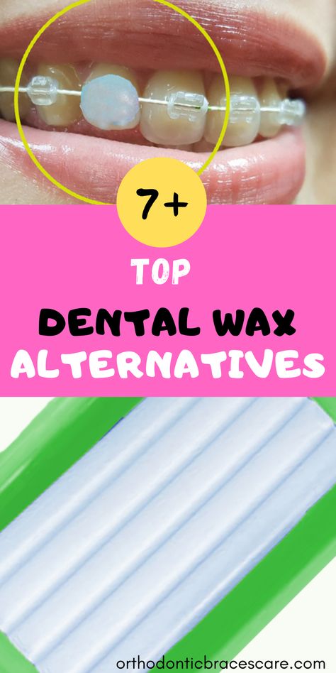 What to use instead of wax for braces? Here are 7 Wax Alternatives For Braces. Apply on your braces to fix broken parts or relieve pain. #braceswaxalternative #waxalternativeforbraces #orthodonticwaxalternative #braceswax #dentalwax #dentalwaxalternative. How To Make Braces, Braces Care, Diy Braces, Braces Colors Ideas, Braces Pain, Braces Cost, Mouth Health, Getting Braces, Braces Off