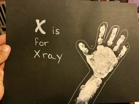 X Is For Craft, Ladybug Room, Baby Art Crafts, Xray Art, Prek Crafts, Abc Crafts, Toddler Art Projects, Alphabet Wall, Alphabet Crafts