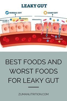 Best Foods And Worst Foods For Leaky Gut #stomach_diseases #liver_function_in_digestive_system #digestive enzyme supplements #digestive_problems_after_gallbladder_removal #rectum_function_in_digestive_system #dry_lips_and_digestive_problems #vitamins_for_gut_health #best_digestive-enzymes_supplement #zandu_pancharishta_uses #small_intestine_and_large_intestine Tea For Leaky Gut, Foods To Avoid With Leaky Gut, Repair Leaky Gut, Leaky Gut Meal Plan Shopping Lists, Fixing Leaky Gut, Leaky Gut Symptoms Natural Remedies, How To Fix Leaky Gut, How To Heal Gut, Leaky Gut Diet Plan Food Lists