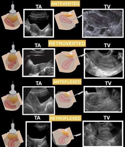 Obgyn Sonographer, Gyn Ultrasound, Fetal Ultrasound, Diagnostic Medical Sonography Student, Ultrasound School, Ultrasound Physics, Obstetric Ultrasound, Medical Radiography, Cardiac Sonography