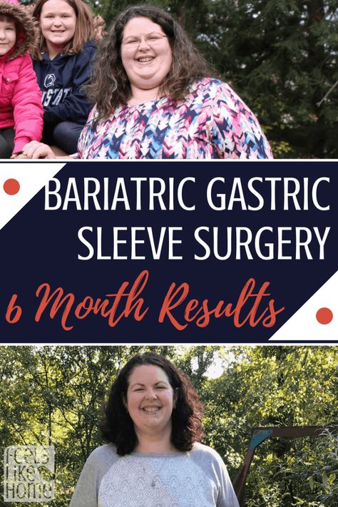 Sleeve Surgery Diet, Gastric Bypass Sleeve, Isagenix Cleanse, Stomach Sleeve, Bariatric Sleeve, Bariatric Diet, Sleeve Gastrectomy, Sleeve Surgery, Bariatric Eating