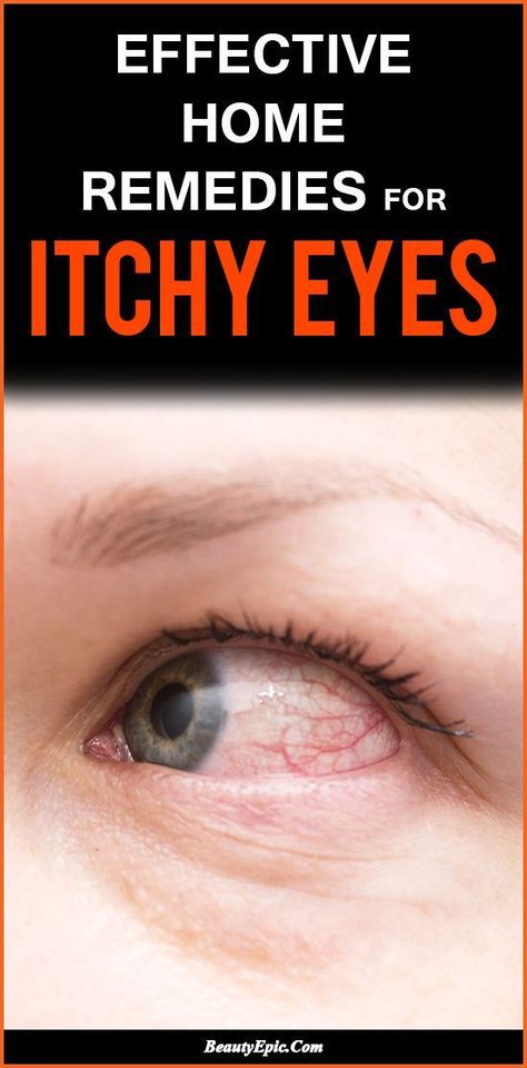 7 Quick Home Remedies For Itchy Eyes That Start Working Right Now Remedies For Itchy Eyes, Vertigo Remedies, Home Remedies For Allergies, What Causes High Cholesterol, Natural Remedies For Migraines, Dry Skin Remedies, Itchy Eyes, Sore Eyes, Home Remedies For Hair