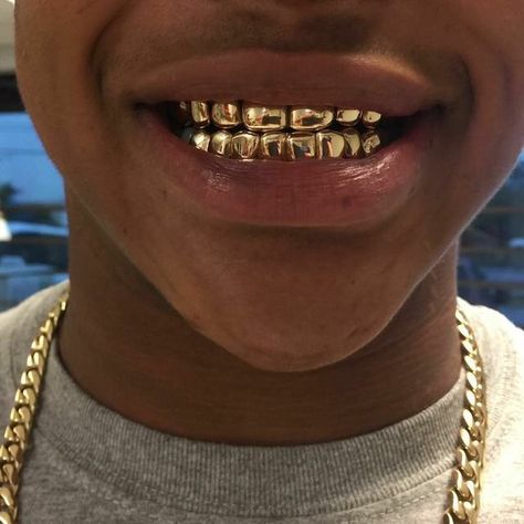 ⚠️WHEN U REPIN GIVE CRED PiNtErEsT:@bbgxloni Gold Slugs, Gold Teeth Grills, White Boy Haircuts, Gangsta Grillz, Grillz Teeth, Facial Routine Skincare, Diamond Grillz, Gold Grill, Diamond Teeth