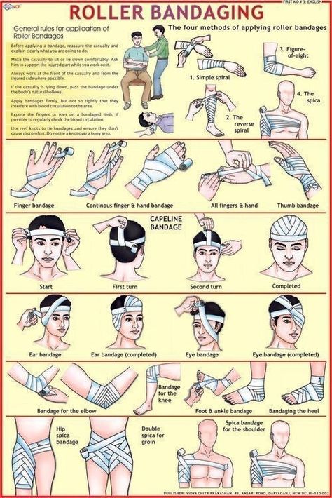 First Aid Tips, Survival Skills Life Hacks, Survival Life Hacks, Apocalypse Survival, Survival Techniques, School Nurse, Survival Life, Medical Knowledge, Wilderness Survival