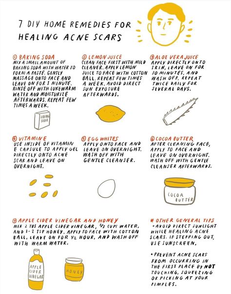 How To Heal Scars Quickly, Healing Acne, Lemon Skin, How To Fade, Baking Soda And Lemon, Natural Beauty Recipes, Acne Scar, Beauty Tricks, Beauty Recipe