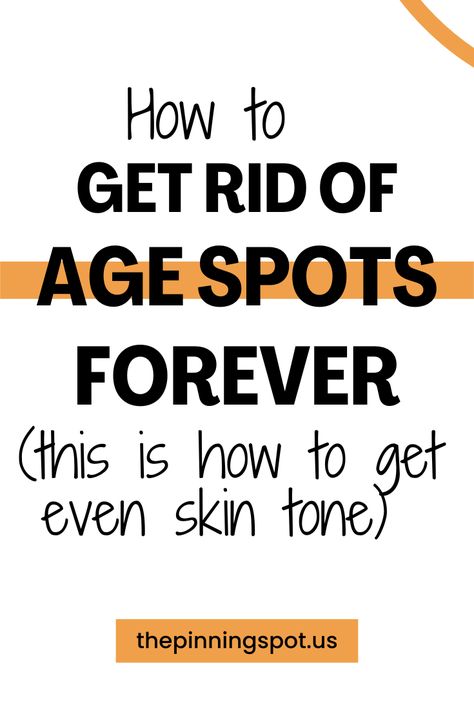 What does it really take to banish age spots? Find out in this comprehensive guide where we reveal three proven methods to achieve a radiant, even skin tone free from age spots. In the post, you'll find effective remedies for age spots on your face and hands as well as best techniques to get rid of brown age spots on your face. The tips and tricks will help you remove brown spots on the skin from the sun or ageing, say hello to clear, ageless skin and  and maintaining ageless beauty. Apple Cider Vinegar Face Toner, Brown Spots On Hands, Skin Spot Remover, Age Spots On Face, Apple Cider Vinegar For Skin, Brown Age Spots, Age Spot Removal, Brown Spots On Skin, Spots On Legs