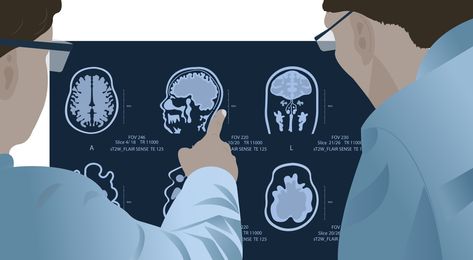 Download the Diagnosis of diseases of the brain in a doctor looking at magnetic resonance imaging . 9009110 royalty-free Vector from Vecteezy for your project and explore over a million other vectors, icons and clipart graphics! Magnetic Resonance Imaging, Magnetic Resonance, A Doctor, The Brain, Disease, Vector Art, Brain, Vector Free, Royalty Free