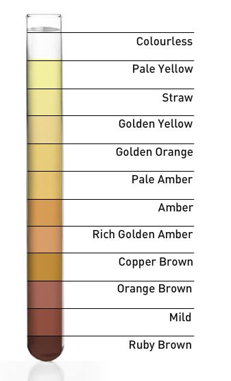 Urine Analysis Lab, Urine Analysis, Family Drinks, Health And Safety Poster, Medical Laboratory Technician, Learn Biology, Health Water, Safety Poster, Body By Vi