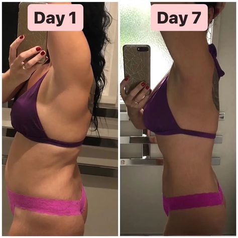 Bringing back one of my fav Day 1 vs Day 7 smoothie detox results to remind you what is possible in just a week, when you put in the DEDICATION 😍💚 have you seen her waisttttttt!! What an amazing difference 🤩👏🏽 #smoothiedetox #weightlossbeforeandafter #7daycleanse 7 Day Cleanse, Smoothie Detox, Calorie Deficit, 2025 Vision, Day 7, Detox Smoothie, Have You Seen, Bring Back, Glow Up?