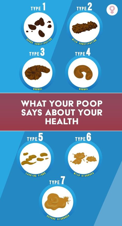 What Your Poop Says About Your Health: Poop is a health indicator. The quality of your feces is your body’s way of signaling whether everything is running smoothly in there or you need to be on alert. This is the reason why questions related to your bowel movement are a staple in every doctor’s general medical history. Best Foods For Constipation, Universal Knowledge, Constipation Remedies, Why Questions, Regular Bowel Movements, Prevent Constipation, Bowel Movement, Wellness Tips, Healthy Habits