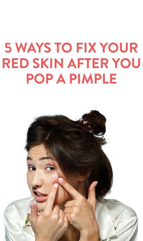 5 Ways To Fix Red Skin After Popping A Pimple Pimples Under The Skin, Health And Beauty Tips, All Things Beauty, Facial Care, Hair Skin, Beauty Secrets, 5 Ways, Skin Makeup, Beauty Care